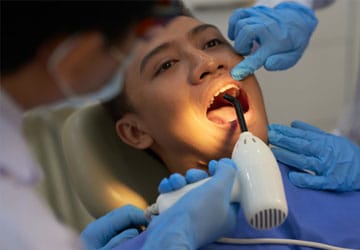 Blanchiment des dents